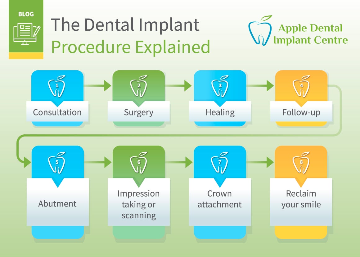 dental implant procedure explained